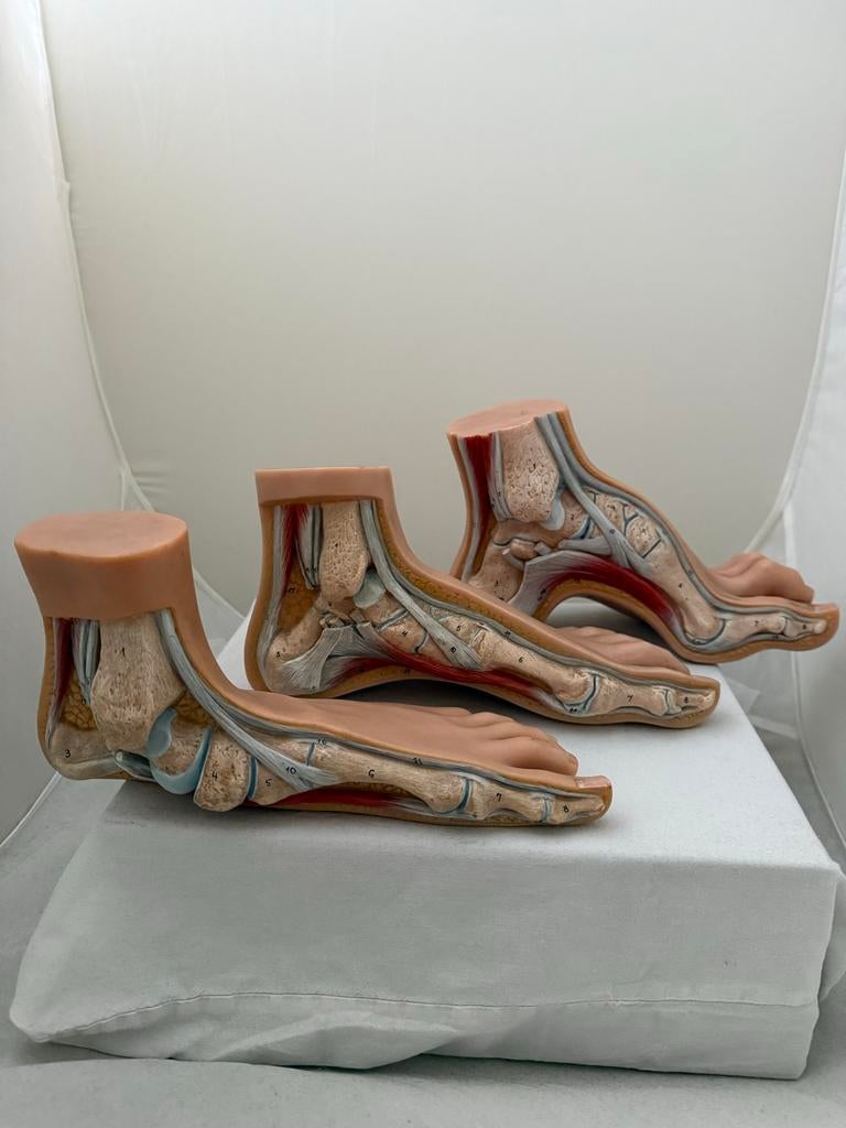 Somso Anatomische Voetmodellen Set (Normaal, Hol, Platvoet), Ophalen of Verzenden, Gebruikt