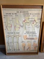 Antieke schoolplaat - Accident, Antiek en Kunst, Ophalen, Natuur en Biologie