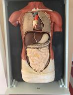 Anatomisch torso gips (plaaster). Zeldzaam, Ophalen