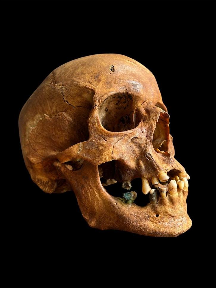 Gezocht mensenschedels cranium skull mensen schedel., Verzamelen, Overige Verzamelen, Ophalen
