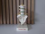 Anatomisch model wervelkolom BLOSSOM BROCANTE, Ophalen of Verzenden