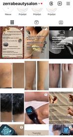 Laser beauty, Witgoed en Apparatuur, Ophalen of Verzenden, Nieuw, Scheren en Epileren