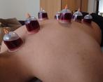 Hjjama/Wet Cupping, Cupping Massage & Dry Cupping, Overige massages