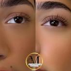 Schoonheidssbehandingen bij Mijomento Beauty in amsterdam, Ophalen of Verzenden, Nieuw, Verzorging