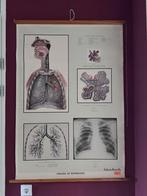 Anatomische schoolplaat - Zeer Goede Staat, Antiek en Kunst, Ophalen of Verzenden, Natuur en Biologie