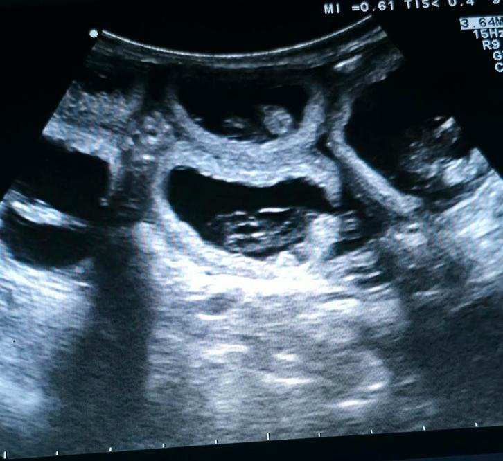 🐶🍼 drachtecho laten maken van uw teefje? 🐶🍼, Diensten en Vakmensen, Dieren | Overige | Verzorging, Oppas en Les, Verzorging