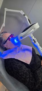 Tanden Bleken Behandeling, Ophalen of Verzenden, Nieuw, Overige typen