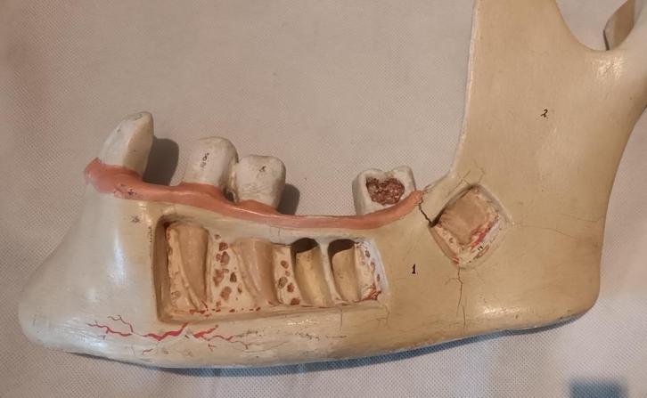 Antiek Medisch Anatomisch model van een kaak Somso, Antiek en Kunst, Curiosa en Brocante, Verzenden