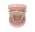 Gebit Met Beugel Menselijk Model / Tandarts Orthodontist, Diversen, Ophalen of Verzenden, Nieuw