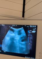 Uit deze unieke combinatie prachtige pups verwacht, Parvo, Overige rassen, 8 tot 15 weken, Meerdere