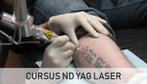 Cursus Yag laser, Ophalen of Verzenden, Nieuw