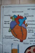Oude schoolplaat m het hart en de bloedvaten, Ophalen of Verzenden, Gebruikt