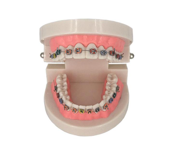 Gebit Met Beugel Menselijk Model / Tandarts Orthodontist, Diversen, Schoolbenodigdheden, Nieuw, Verzenden