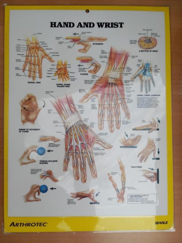 Fraaie plaat met anatomisch model van menselijke hand, spier, Verzamelen, Posters, Gebruikt, Dier of Natuur, A1 t/m A3, Ophalen of Verzenden
