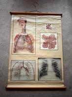 Gave Antieke Medische Plaat Wandplaat, Antiek en Kunst, Ophalen, Natuur en Biologie