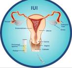 Donor gezocht, Ophalen