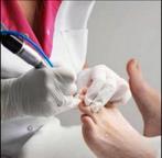 Pedicure, Ophalen, Nieuw