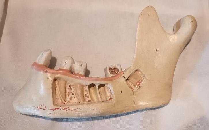 Antiek Medisch Anatomisch model van een kaak Somso, Antiek en Kunst, Curiosa en Brocante, Verzenden