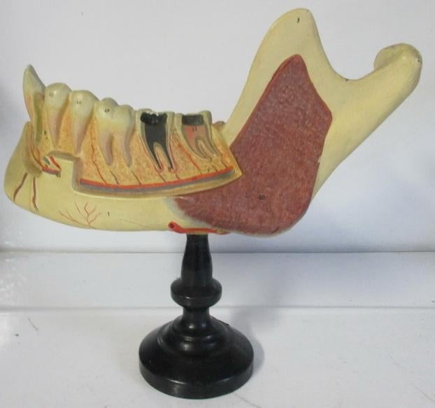 antiek anatomisch model van tanden Ivac Brussel 4A, Ophalen