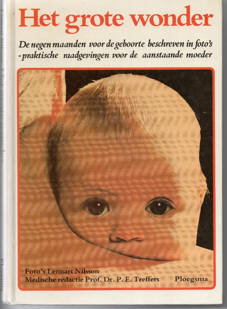 Het grote wonder - Lennart Nilsson, Boeken, Ophalen of Verzenden, Gelezen, Zwangerschap en Bevalling