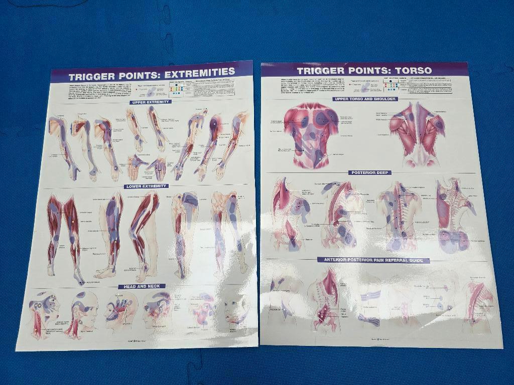 Poster triggerpoints Wolters Kluwer nw 58 euro, Ophalen, Gebruikt, Benen, Overige typen