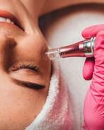 Dermapen, Sieraden, Tassen en Uiterlijk, Uiterlijk | Gezichtsverzorging, Ophalen of Verzenden, Zo goed als nieuw, Gehele gezicht