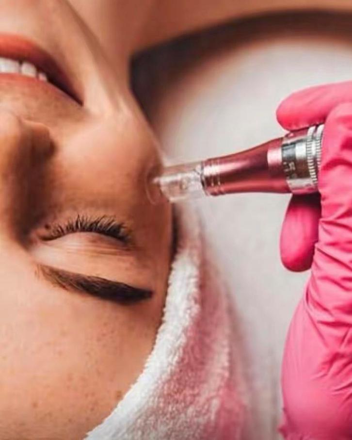 Dermapen, Sieraden, Tassen en Uiterlijk, Uiterlijk | Gezichtsverzorging, Zo goed als nieuw, Gehele gezicht, Ophalen of Verzenden