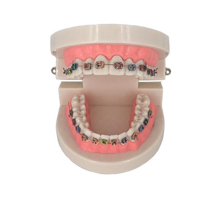 Gebit Met Beugel Menselijk Model / Tandarts Orthodontist, Diversen, Schoolbenodigdheden, Nieuw, Verzenden
