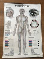 Acupunctuur poster i, Ophalen, Zo goed als nieuw, Deurposter of groter, Overige onderwerpen