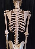 Somso anatomisch skelet man, Ophalen, Gebruikt