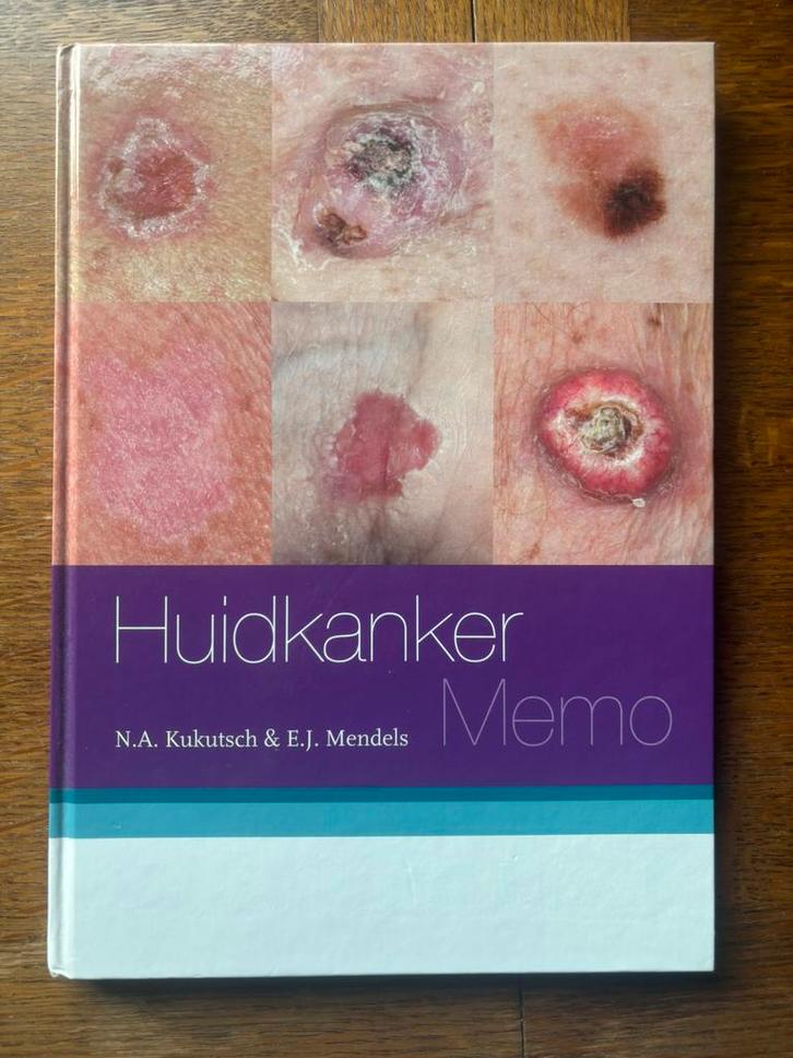 Huidkanker memo, Boeken, Studieboeken en Cursussen, Zo goed als nieuw, HBO, Ophalen of Verzenden