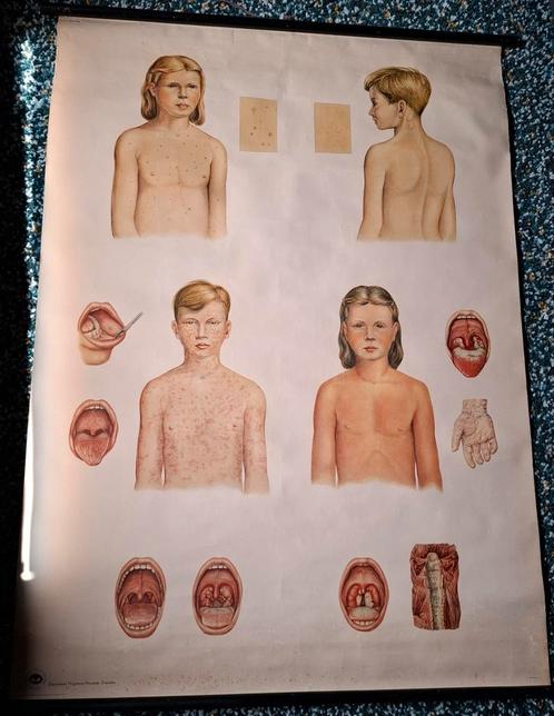Anatomische Poster, Antiek en Kunst, Antiek | Schoolplaten, Natuur en Biologie, Verzenden