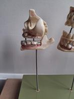 Medisch model Somso, Antiek en Kunst, Curiosa en Brocante, Ophalen of Verzenden