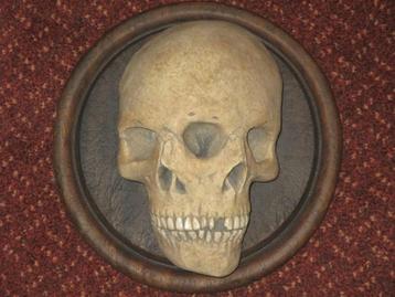 Vergroeide Tweeling Schedel REPLICA unieke Skull op Wandbord beschikbaar voor biedingen