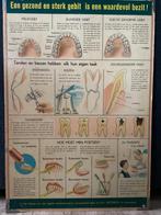 Tandarts poster, Ophalen of Verzenden, Natuur en Biologie