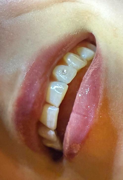 Toothgem (ook aan huis), Sieraden, Tassen en Uiterlijk, Uiterlijk | Gezichtsverzorging, Nieuw, Verzorging, Ophalen