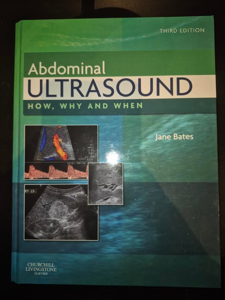 Abdominal Ultrasound - Jane Bates - Derde Editie, Boeken, Verzenden, Jane Bates, Nieuw, Overige onderwerpen