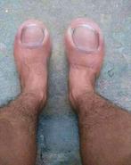 Ambulant Pedicure, Ophalen of Verzenden, Nieuw, Overige typen