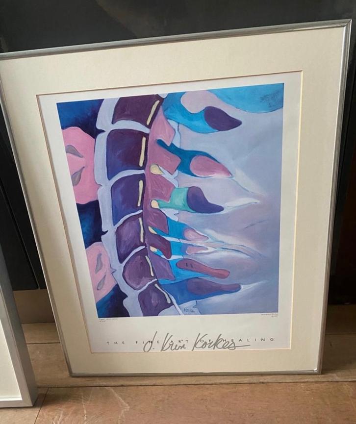 Ingelijste poster: fugue ( fysiotherapie), Huis en Inrichting, Woonaccessoires | Lijsten, Gebruikt, 50 tot 75 cm, 50 tot 75 cm