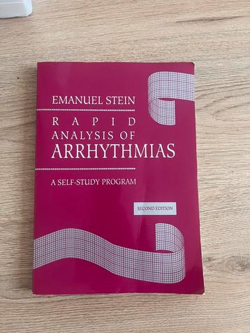 Rapid analysis of arrhythmias beschikbaar voor biedingen