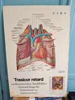 Houten anatomie plaat, Ophalen, Natuur en Biologie