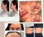 Lip fillers btx, Ophalen of Verzenden, Zo goed als nieuw, Lippen, Verzorging