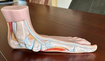 Somso anatomisch model anatomie voet mens platvoet