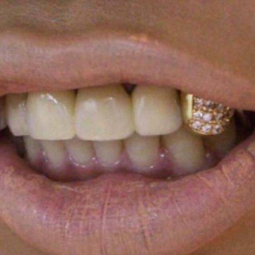 Gouden tand, Sieraden, Tassen en Uiterlijk, Uiterlijk | Mondverzorging, Nieuw, Lipbalsem, Ophalen of Verzenden