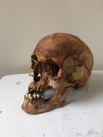 schedel menselijke mensen schedel mens beschikbaar voor biedingen