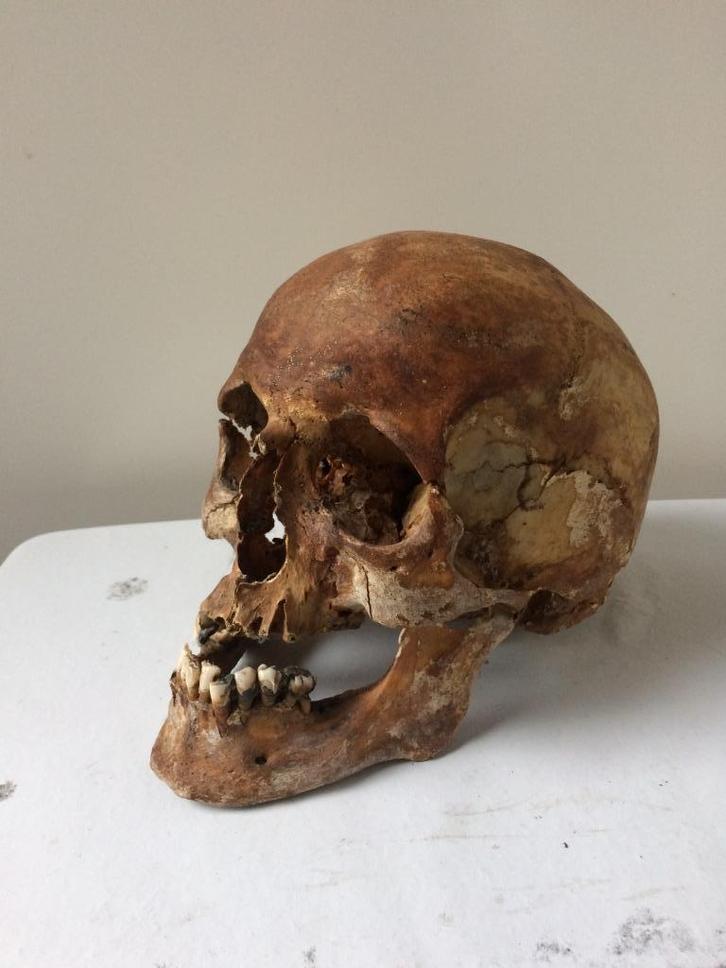 schedel menselijke mensen schedel mens, Verzamelen, Overige Verzamelen, Gebruikt, Ophalen of Verzenden