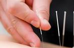 Acupuncture  Massage. Cupping in Amsterdam, Ontspanningsmassage