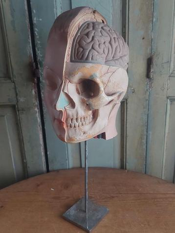 Oud lifesize anatomisch hoofd schedel/ gezicht op statief  beschikbaar voor biedingen