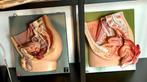 Anatomie 2 anatomische bekken modellen van Somso, Antiek en Kunst, Curiosa en Brocante, Ophalen of Verzenden