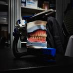 {Gartis Gebitsprothese Boven+Onder}️, Ophalen of Verzenden